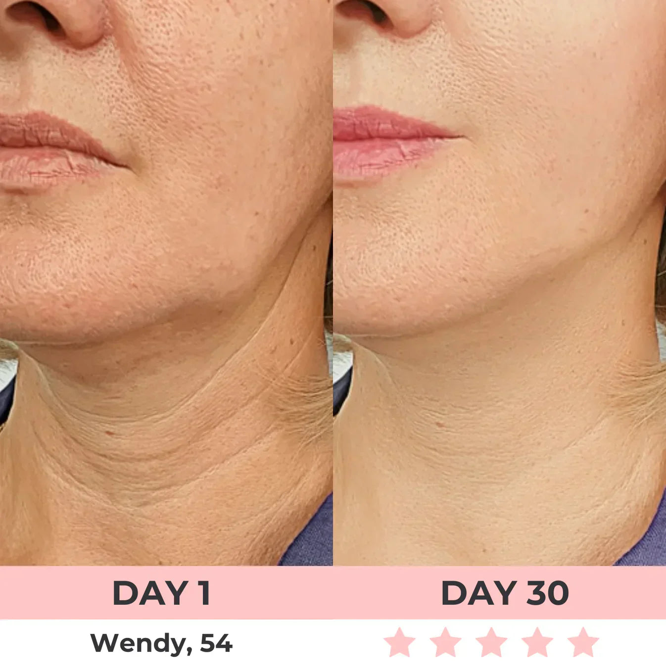 7-in-1 LED Facial Sculptor